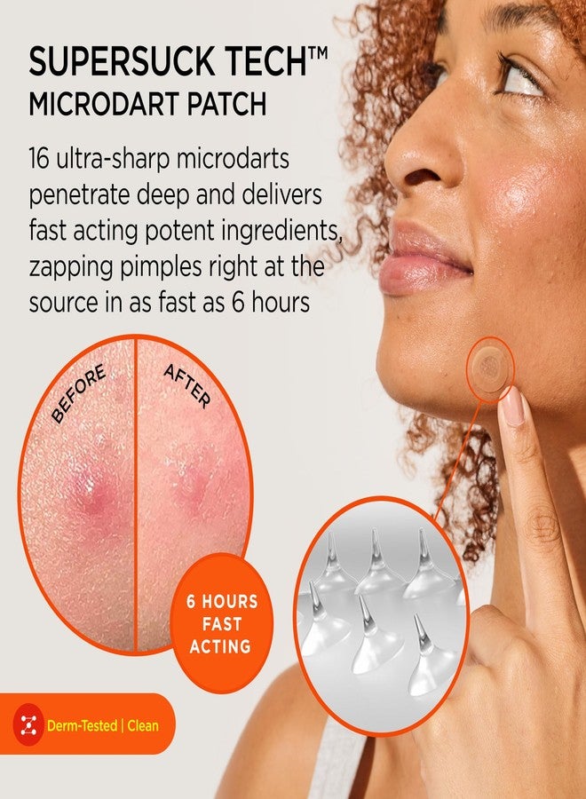 ZitSticka Killa Pimple Patches for Face - World's Most Potent Pimple Patch with Fast-Acting Microdarts - Starts Working within 6 Hours for Deep, Early-Stage Zits - Mini 16 Count - Image 2